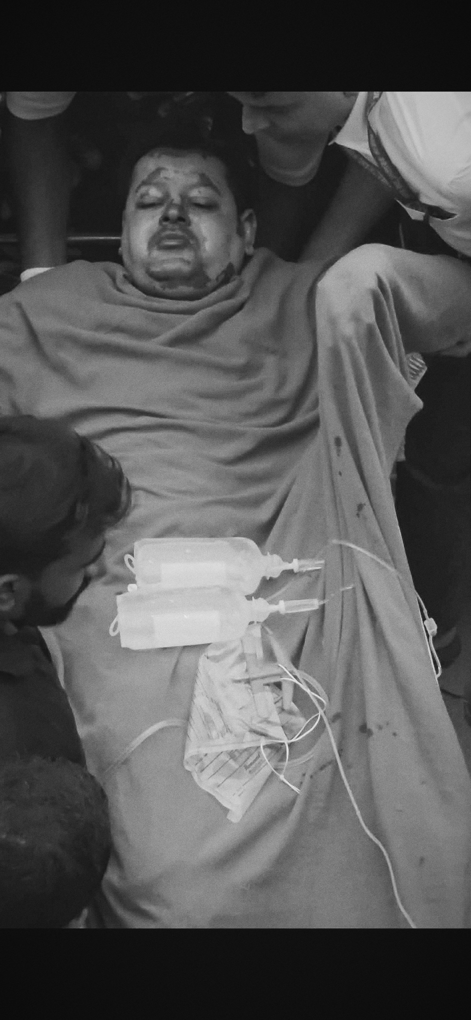 आत्मदाहको प्रयास गरेका विवेक मण्डलको उपचारकै क्रममा निधन- परिवारलाई आजीवन सहयोग गर्ने सांसद अमरेश सिंहको घोषणा